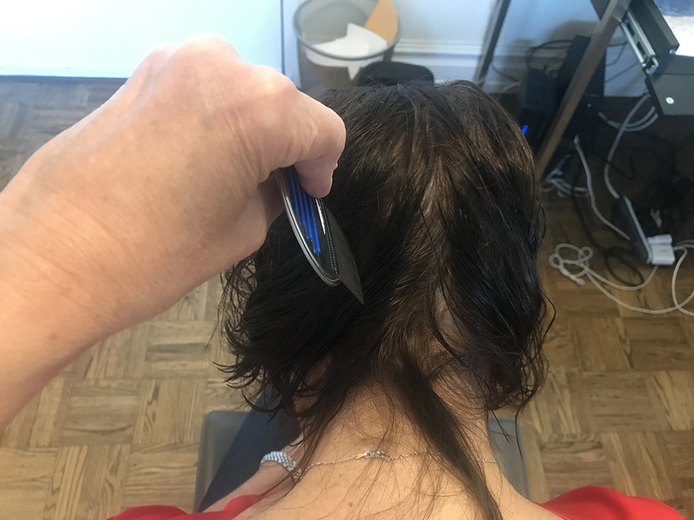 Chicago, Illinois Lice Treatment & Lice Removal Service LiceDoctors